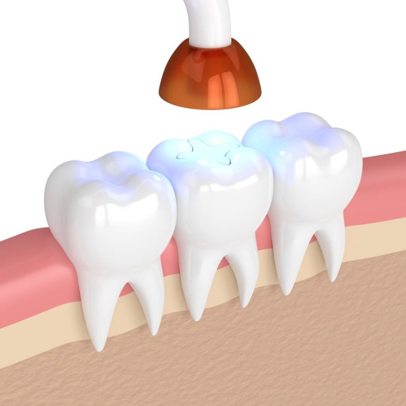 تقويم الاسنان, ابتسامة المشاهير, هووليود سمايل, تبييض الاسنان, تنظيف الاسنان, علاج الاسنان, افضل اخصائي تقويم الاسنان في ابوظبي, اجمل ابتسامة في ابوظبي