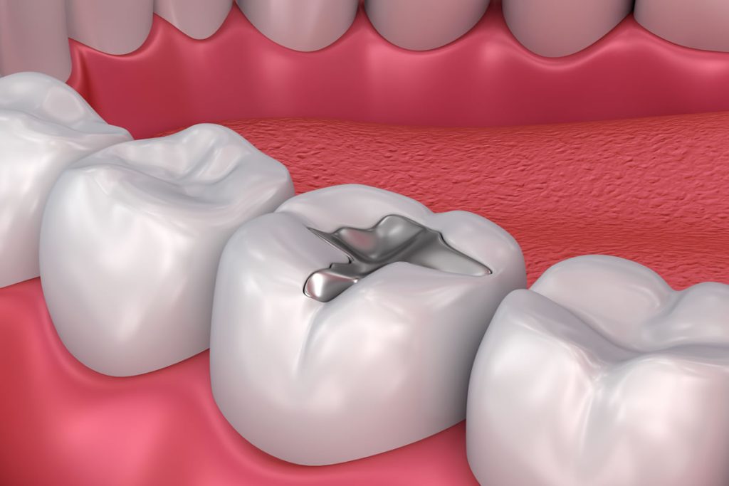إجراءات طب الأسنان العام: تحسين ابتسامتك وصحة فمك