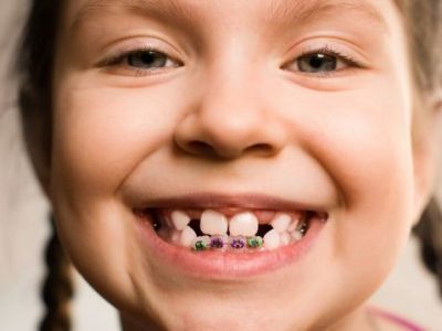 تقويم الاسنان, ابتسامة المشاهير, هووليود سمايل, تبييض الاسنان, تنظيف الاسنان, علاج الاسنان, افضل اخصائي تقويم الاسنان في ابوظبي, اجمل ابتسامة في ابوظبي